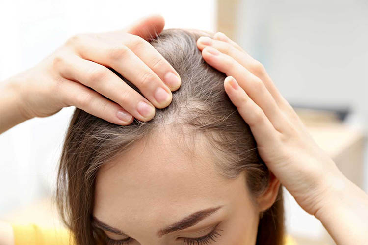 ¿EN QUÉ SE DIFERENCIA LA ALOPECIA DE LA CAÍDA DEL PELO?